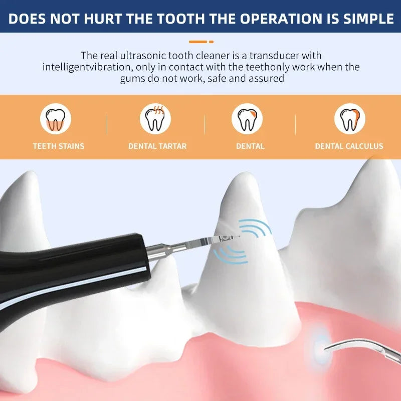 Pet Teeth Cleaning Tools Dog Toothbrushes Dog Supplies Pet Grooming Toothbrush Dental Stain Cleaning Pen Professional Products