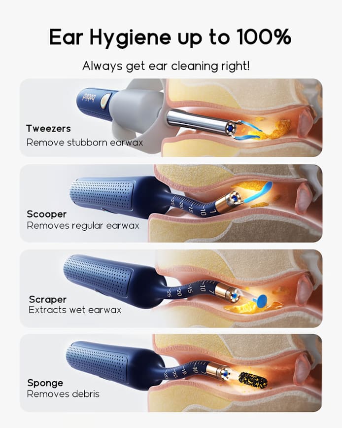 2025 New Arrival Bebird EarSight Plus I35R R37R D39R Visual Earpick Bendable & Affordable All-in-1 Ear Rod Earwax Removal Kits